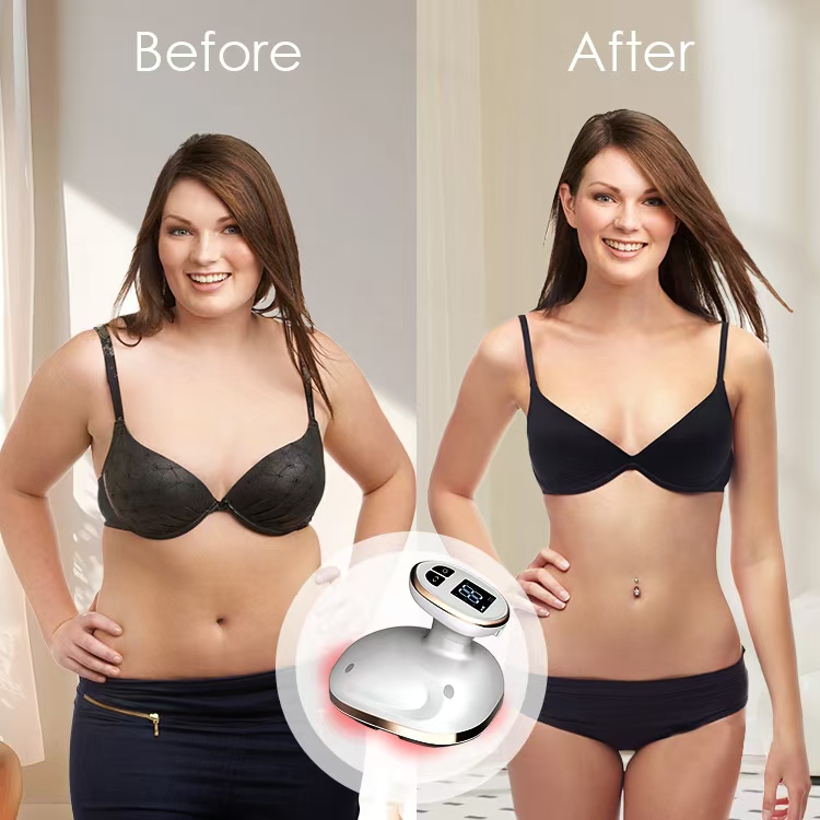 Body Shaping Machine Stretch Mark Massager Tightening Device